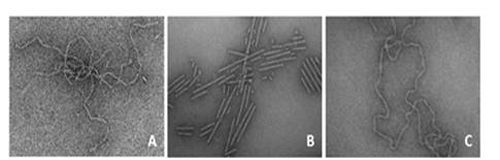 Transmission electron micrographs of amyloid fibrils