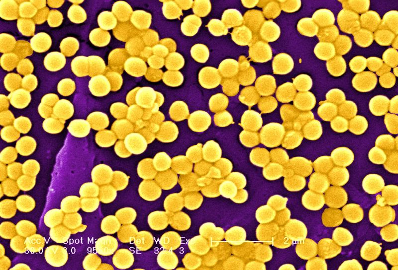 Visualisation of Staphylococcus aureus