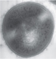 electronmicrograph showing cell wall thickness of Staphylococcus aureus