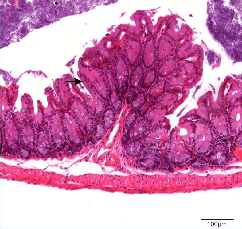 section of cecum showing columnar epithelium