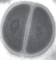 electron micrograph of cell walls of S. aureus