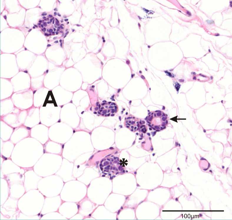 section of mammary gland showing lactiferous duct, acinus and adipose tissue