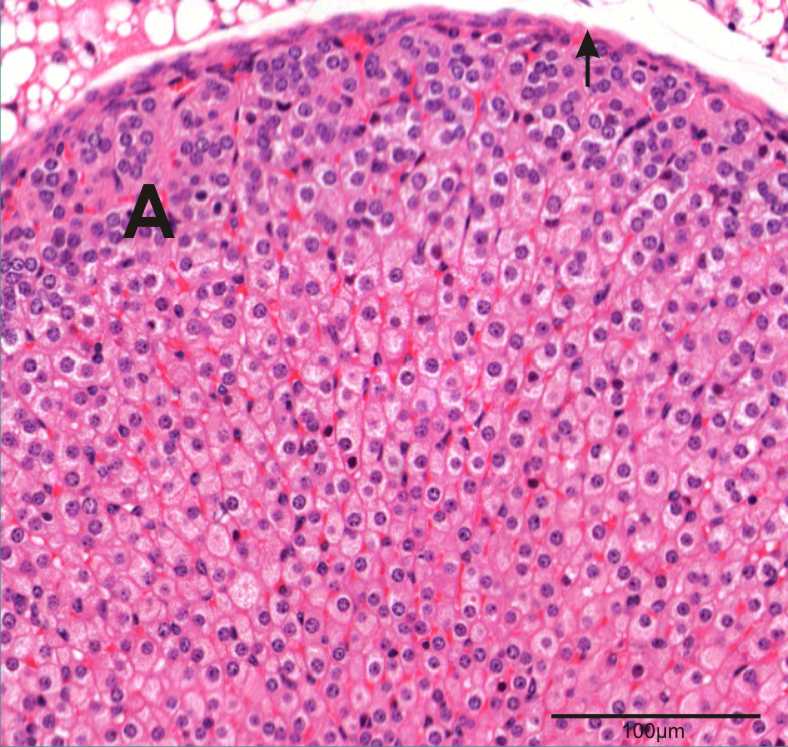 section of adrenal gland showing fibrous connective tissue capsule and cortex region