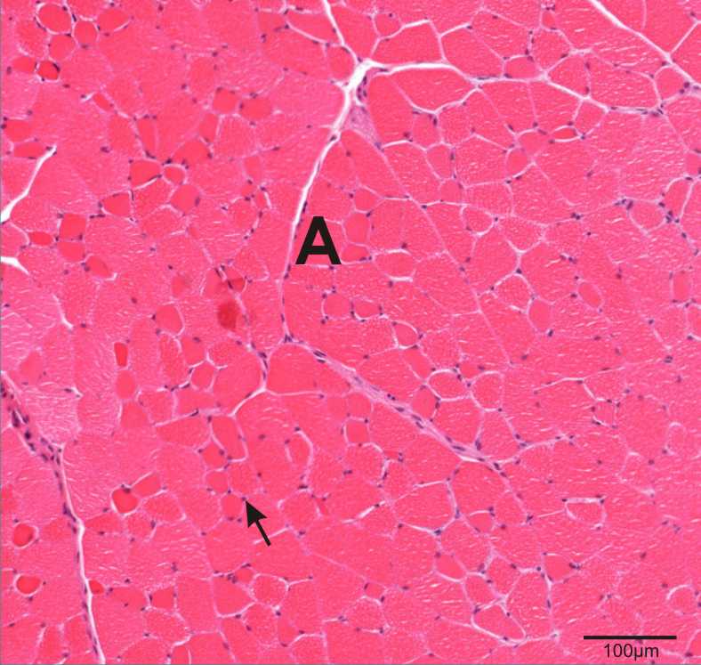 skeletal muscle section showing muscle fibres and peripherally located nuclei