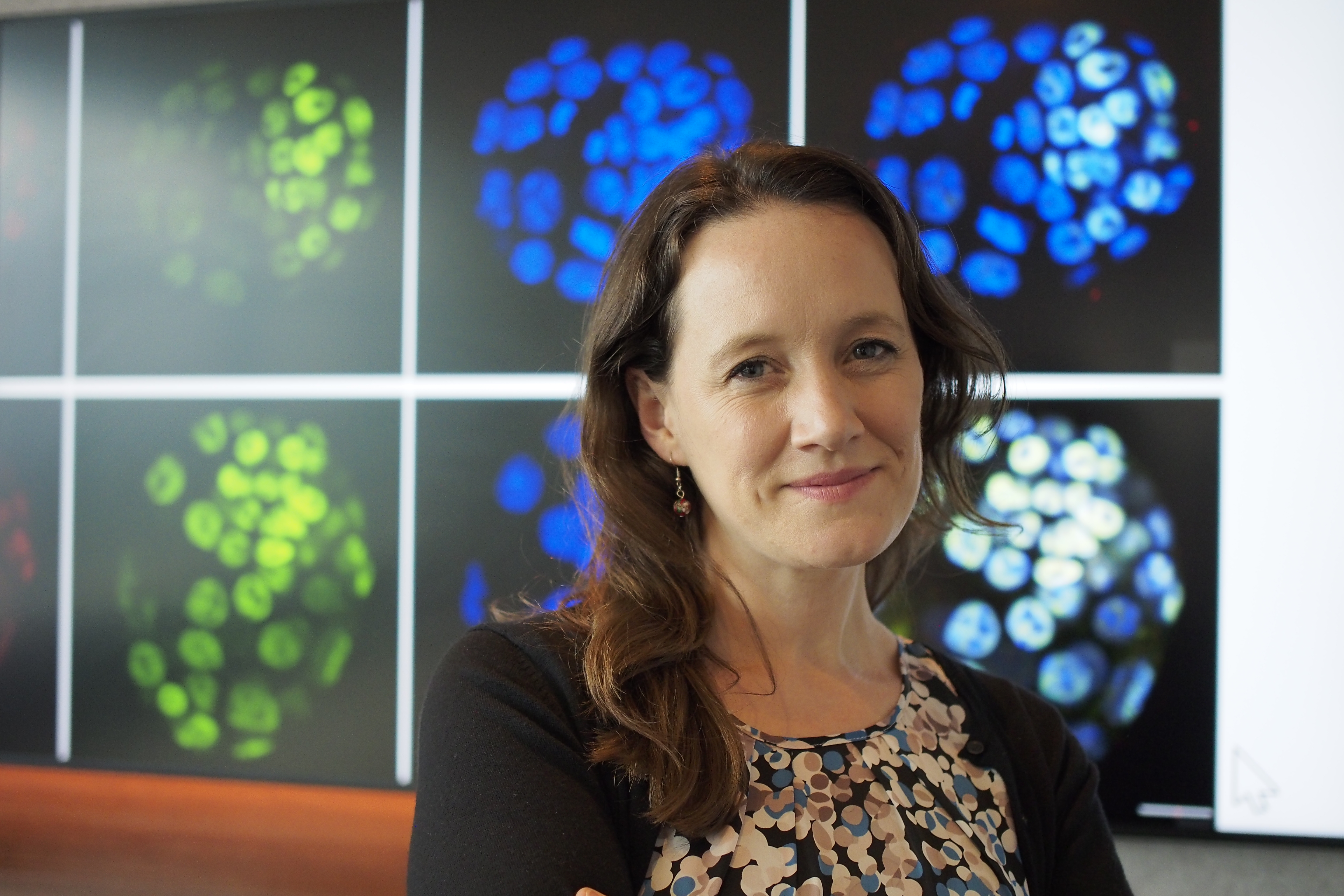 Woman poses with images of cells behind her