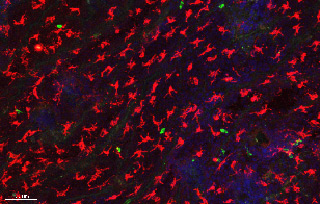 Dendritic Epidermal T cells in mouse epidermis. γδ T Cells (red), CD8 T Cells (green) and nuclei (blue)