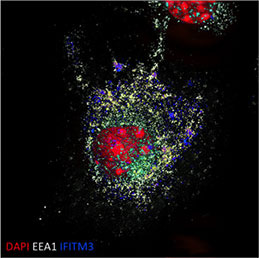 Super-resolution microscope image of a dendritic cell depicting the expression of IFITM3(blue) in intracellular vesicles (EEA1+).