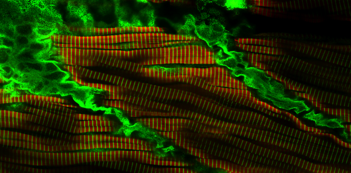 of skeletal muscle , zebrafish embryo, anti-Myosin (red) and anti-Actinin (green) antibodies