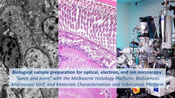 Two microscope images next to a photo of a helium ion microscope