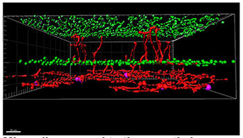 Microglia respond to therapeutic laser treatment