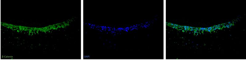 Sections of tooth with beta catenin protein and cell nuclei fluorescently labelled