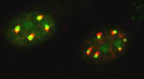 CLSM images of nuclei of cells expressing rabies virus protein