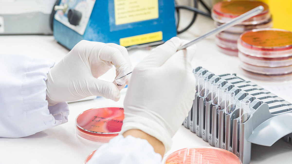 Agar plate in laboratory